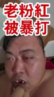 这种蒙医治好了吗？�
